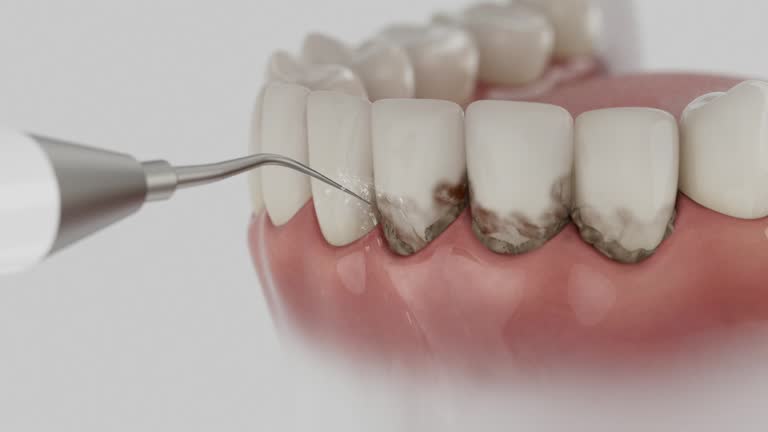 Reliable Teeth Cleaning And Checkup contractor in Hyde County County, SD by Dentist Open Now